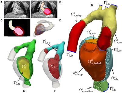 Towards a Computational Framework for Modeling the Impact of Aortic Coarctations Upon Left Ventricular Load